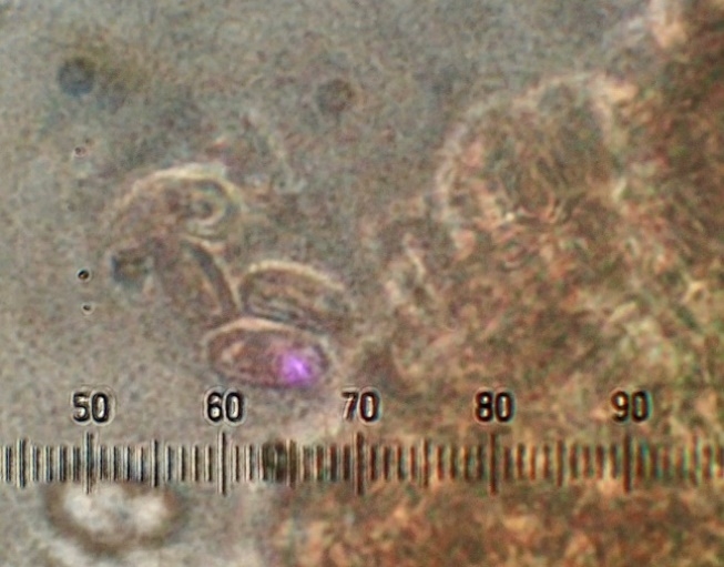 Spores de Hygrophoropsis fuscosquamula