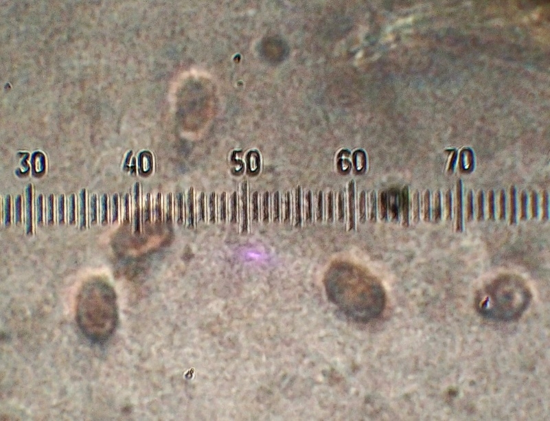 Spores de Hygrophoropsis rufa